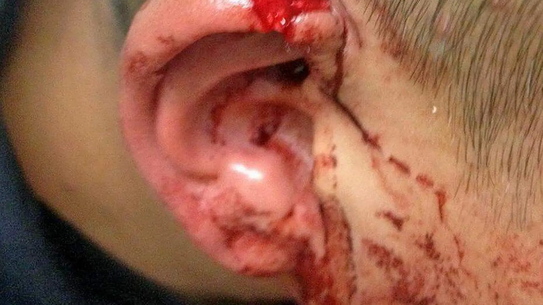 oreja mutilada